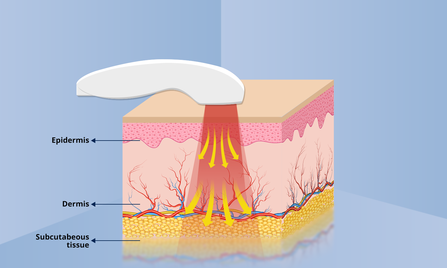 Is Cold Laser Therapy A Hoax?