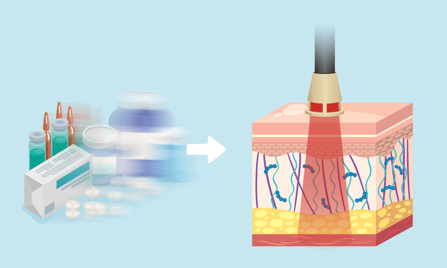 Can Laser Therapy Help the Current Opioid Dilemma?