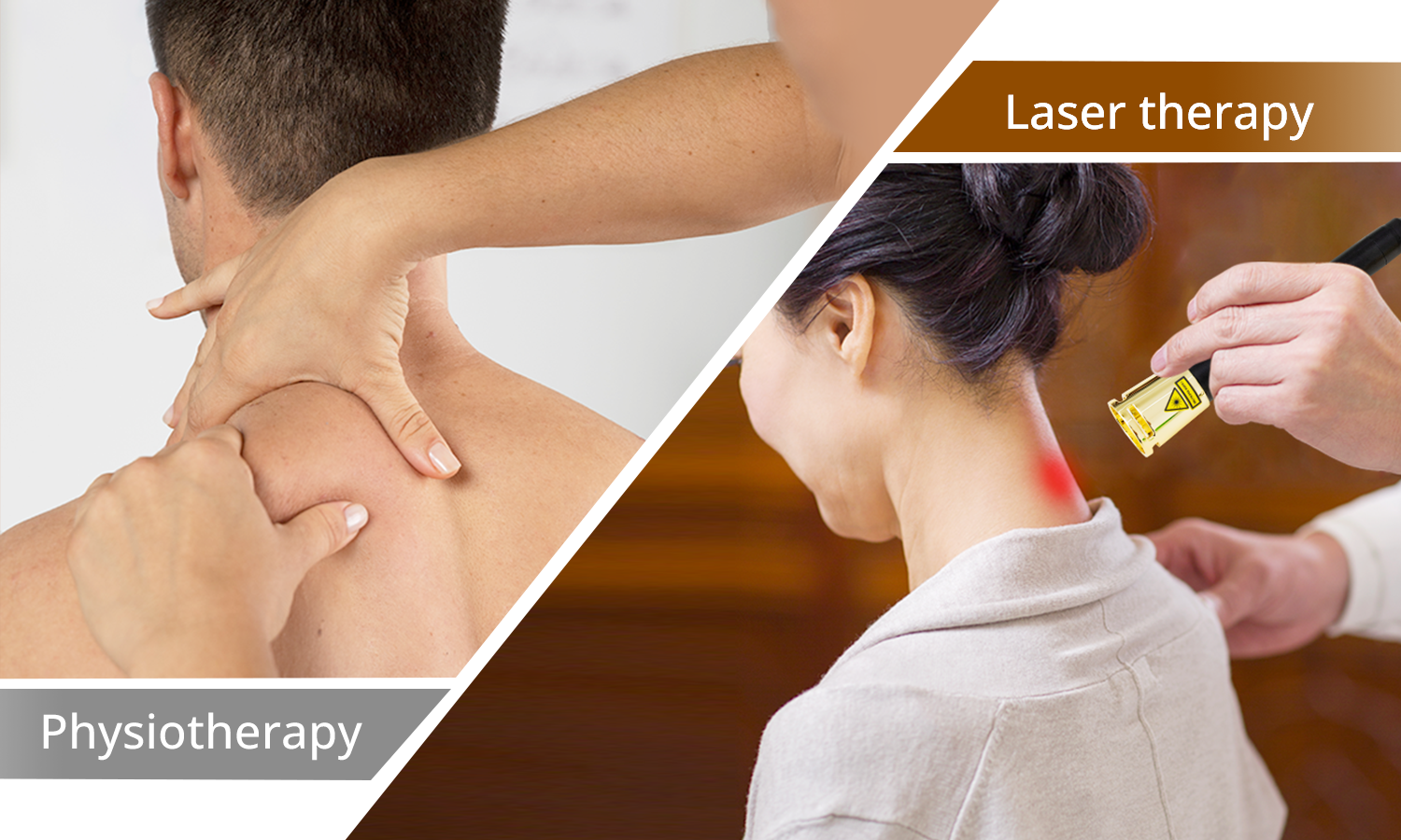 High-Level Laser Therapy vs Physiotherapy for Cervical Pain